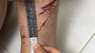 SOROCABA – A 39-year-old French tourist was bitten by a shark when I swam at Praia do Lambert, in Ubatuba, north coast of São Paulo. The man sustained deep injuries to his leg and needed hospital care. The case happened […]