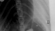 Sadly, the coins that Tasko the sea lion swallowed at the Adalaide Zoo in Australia weren’t of the edible variety – like the ones kids enjoy at Chanukah time. Tasko had to undergo surgery to remove the money he gulped […]