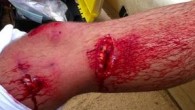 IT’S a scene which plays out in every surfer’s worst nightmares. At about noon last Wednesday, Daniel Falconbridge, 24, of Jannali, sat on his surfboard waiting for a wave at Garie Beach when he noticed a three-metre long dark shape […]