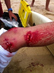 IT’S a scene which plays out in every surfer’s worst