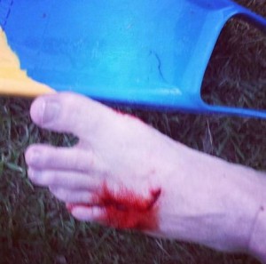 A SURFER has escaped with minor cuts and stitches after fighting off