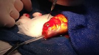 Daily Mail’in haberine göre, Lort Smith Hayvan Hastanesi’nden Dr. Tristan Rich, 80 gram ağırlığındaki Japon balığının kafasında çıkan tümörü ameliyatla aldı. “George” adlı Japon balığının başındaki tümörün büyümesini takip eden sahipleri, tümörün on yaşındaki balığın nefes almasını, yüzmesini ve görmesini […]