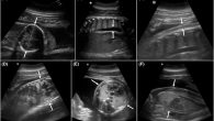 Swimming through petroleum-infested waters is not exactly good for a dolphin’s health, and if that dolphin is pregnant, the ramifications are even more dire. Following the Deepwater Horizon oil spill in 2011, successful pregnancies in bottlenose dolphins (Tursiops truncatus) plummeted, […]