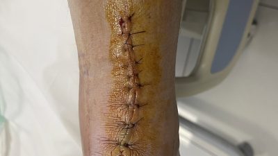 10 gün önce Perşembe günü Lymington’da koşarken bir sakarlık oldu
